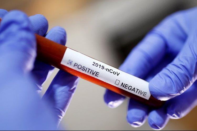 Meksikada koronavirus daşıyıcılarının sayı artdı