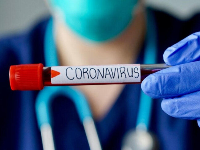 Dünyanın virus mənzərəsi necə dəyişir? - RƏQƏMLƏR